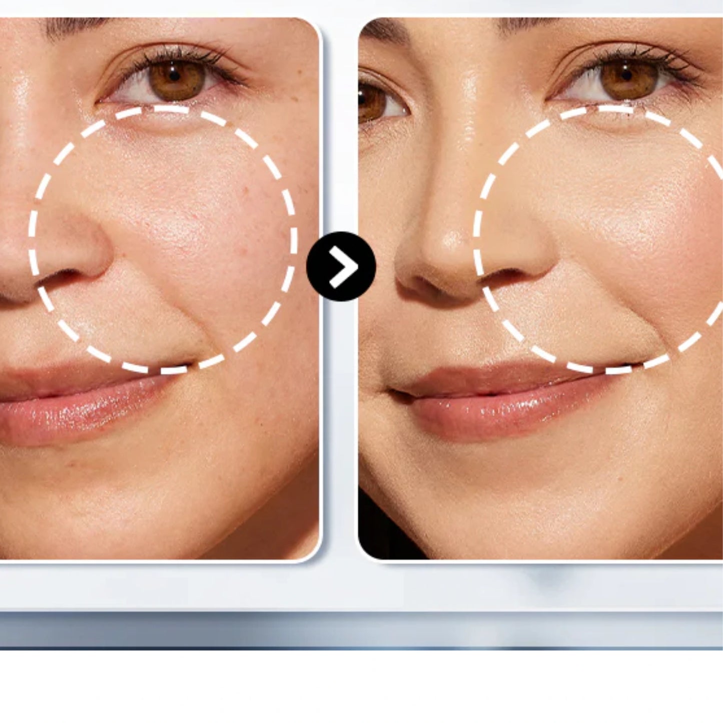 BlackOut Lanbena | Blackhead Removal Cream + Strips (60 pcs) - Aveneli