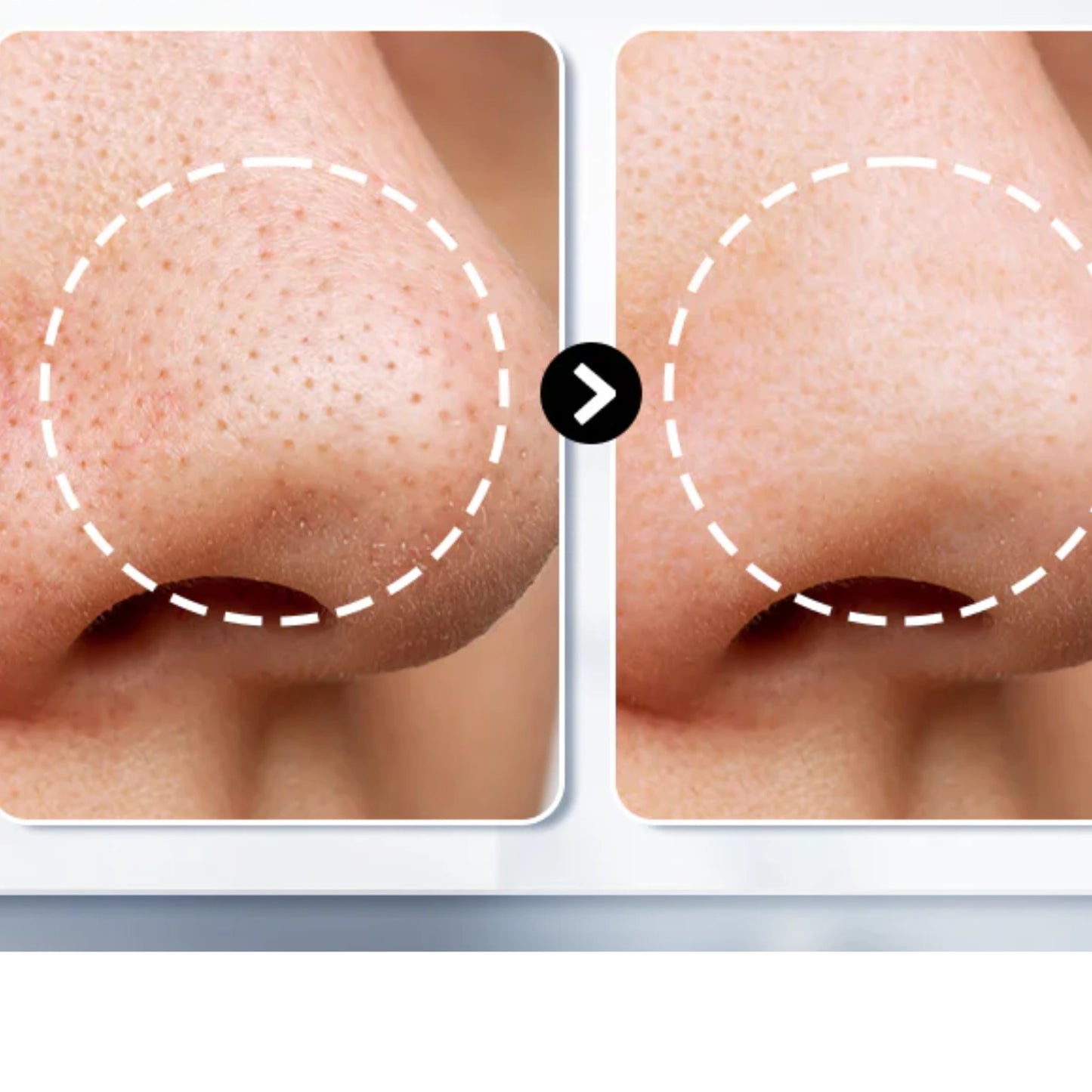 BlackOut Lanbena | Blackhead Removal Cream + Strips (60 pcs) - Aveneli