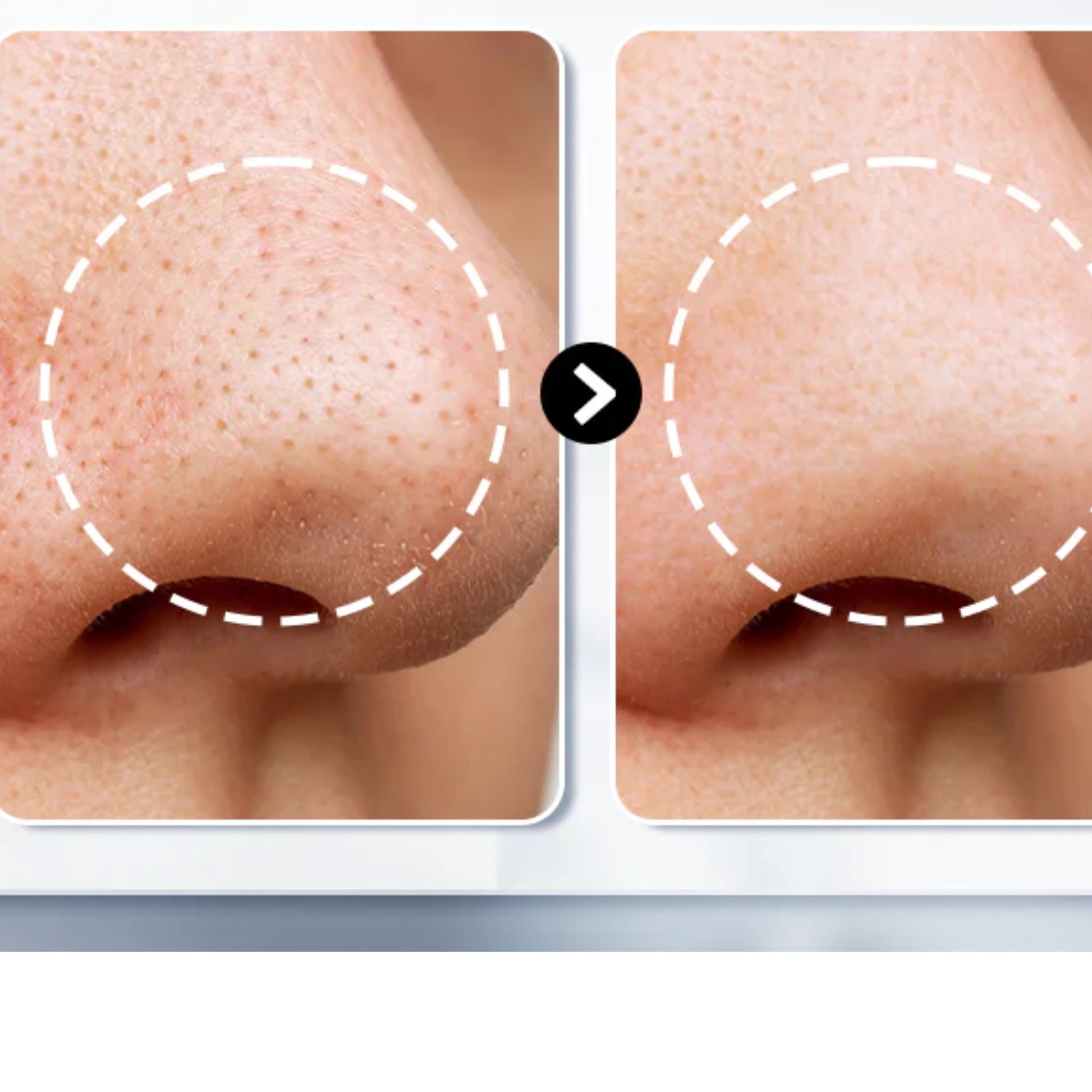 BlackOut Lanbena | Blackhead Removal Cream + Strips (60 pcs) - Aveneli