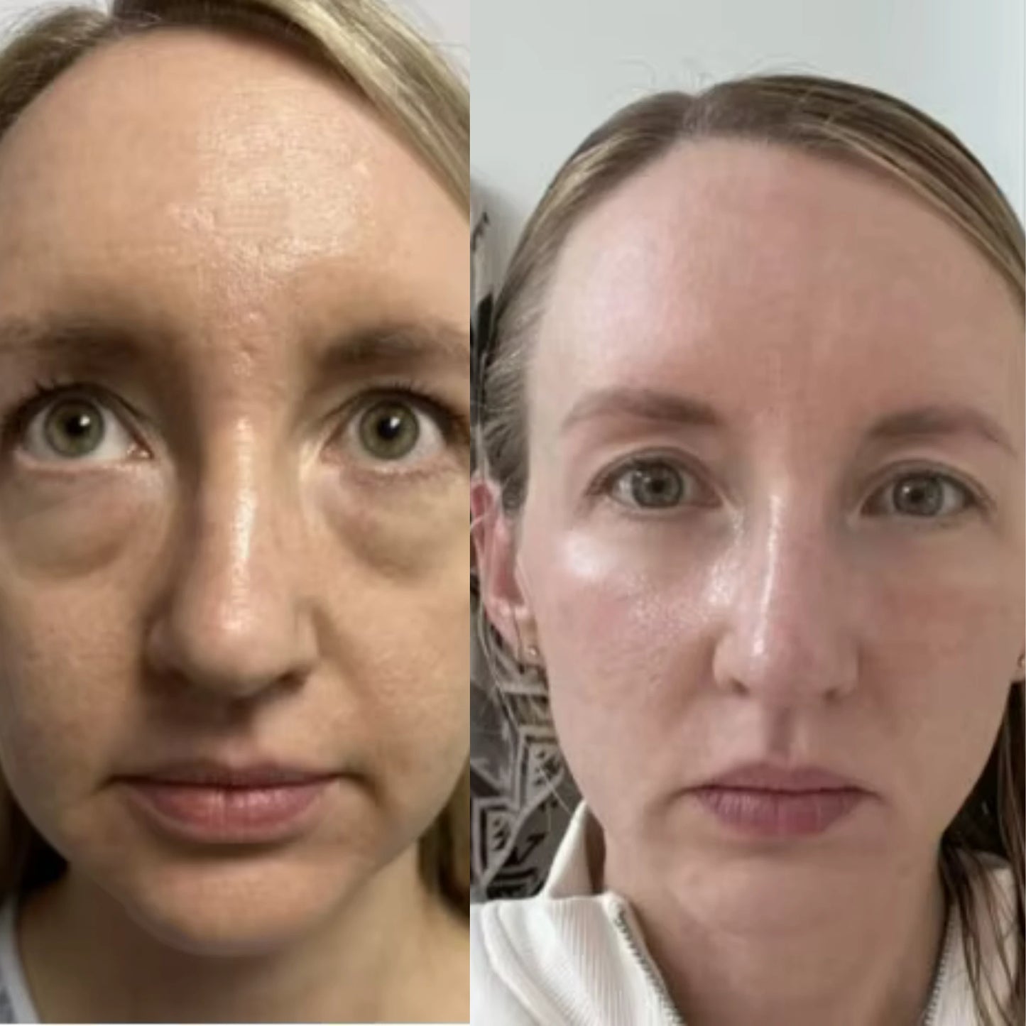 K-Beauty Seoul Retinal - Aveneli