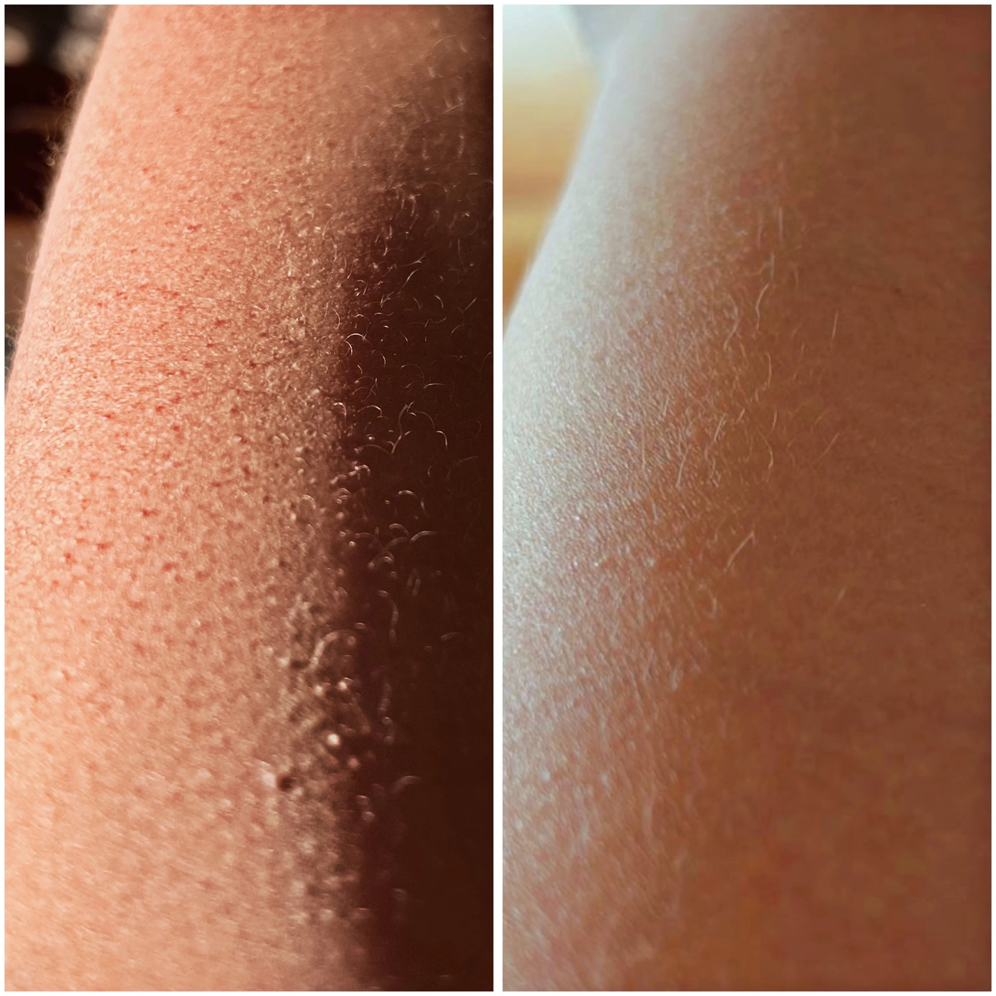 Velura Touch™ Ritual Set – Skin That Feels as Good as It Looks - Aveneli