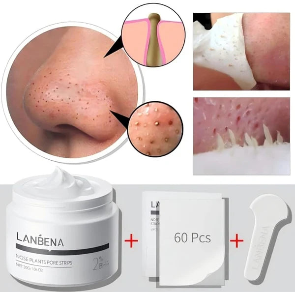BlackOut Lanbena | Blackhead Removal Cream + Strips (60 pcs) - Aveneli