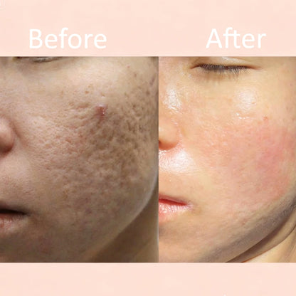Scarvia Repair Gel