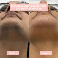 Vellis Serúm Botaníco