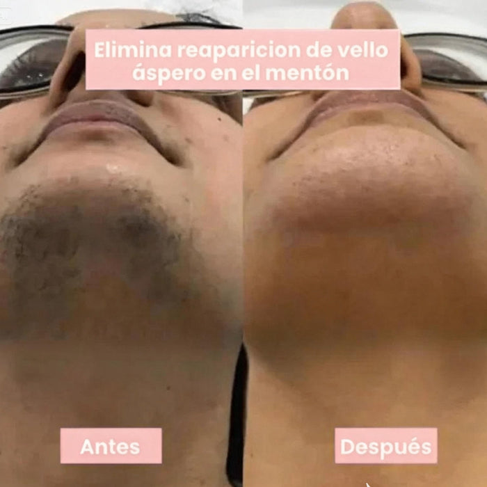Vellis Serúm Botaníco