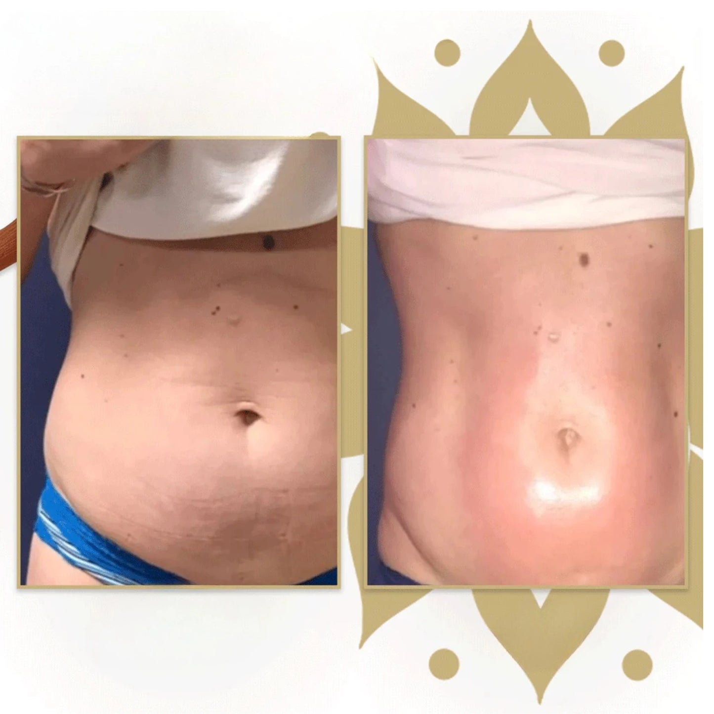 Wood Therapy Roller – Lymphatic Massage & Body Care - Aveneli