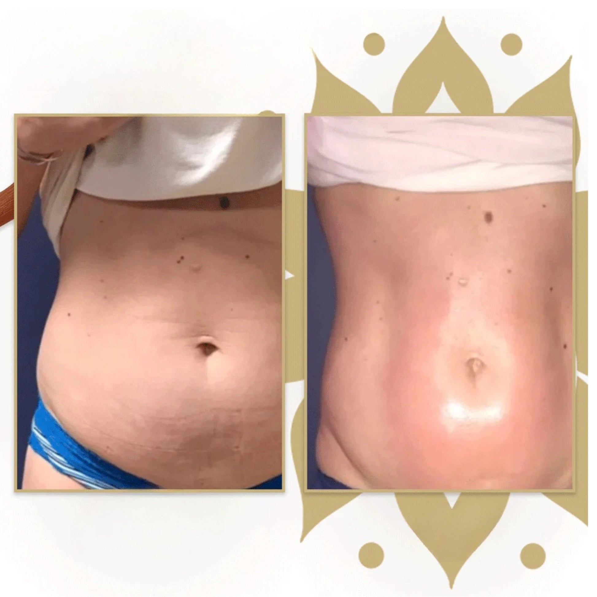 Wood Therapy Roller – Lymphatic Massage & Body Care - Aveneli